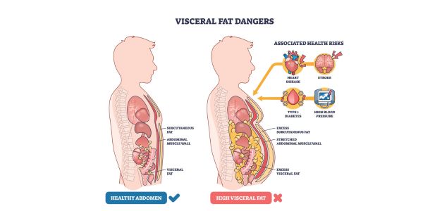 內臟脂肪過高嗎？3招檢測、4高風險族群，教你消除內臟脂肪！-1